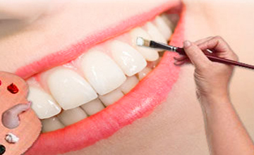 Bryan Dental Cosmetic Dentistry service